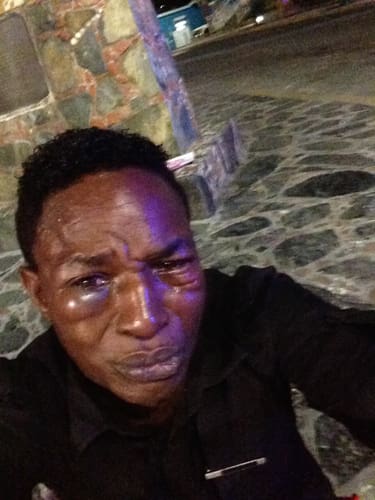 Tommy Farrell Brutally Attacked by Group of Young Tourists in Franklin Powell Park