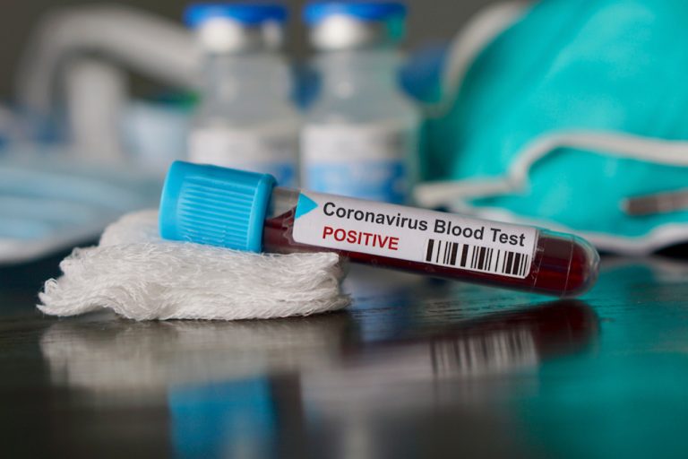 USVI Still Has Zero COVID-19 Cases; Testing Has Begun as Virus Hits Caribbean