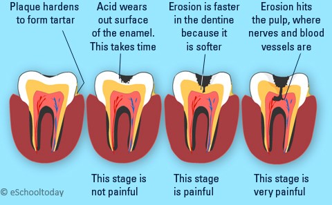 The Important Relationship Between Teeth and Nutrition Is Explained