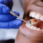 teeth-dental